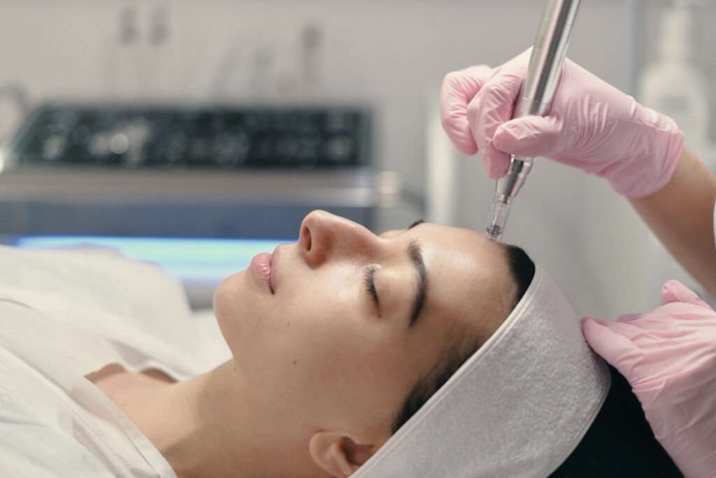 Microneedling in Howick | Collagen Induction Therapy at Estilo Hair & Beauty